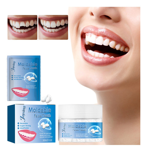 Kit De Reparación De Dientes En V, 2 Piezas, Dientes Postizo