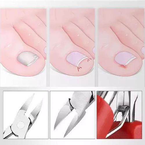 Set De Alicates Para Destapar Y Cortar Uñas Encarnadas