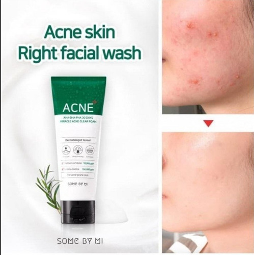 Imagen 3 de 4 de Some By Mi Miracle Acne Foam Espuma Facial 100 Ml Outlet