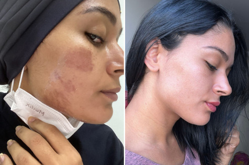 Melanin Defense Serum Clareador De Manchas