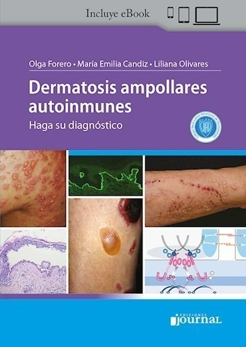Forero / Candiz / Olivarez Dermatosis Ampollares Autoinmunes
