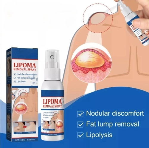 Productos Para El Cuidado De La Piel Lipoma Fatty Knot En Ae