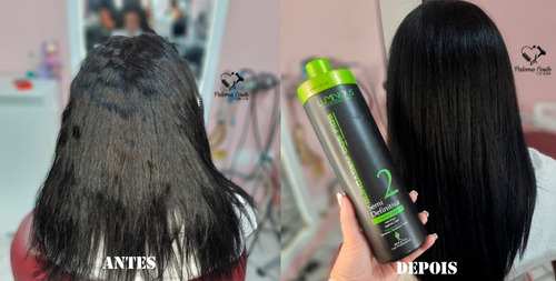 Plastica Dos Fios Blindagem Semi Definitiva + B-tox + Brinde
