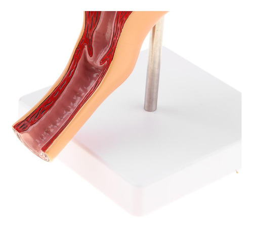 Modelo Anatômico Do Órgão Reprodutor Feminino, Útero, Vagina