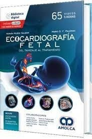 Ecocardiografía Fetal Del Tamizaje Al Tratamiento - Muñoz S