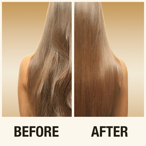 Inoar - Conjunto De Shampoo E Condicionador Absolut Daymoist
