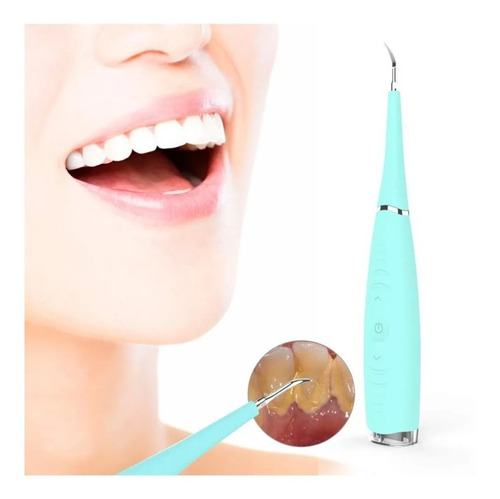 Raspador Dental Ultrasónico Limpiador De Dientes Quita Sarro