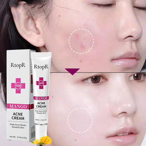 Crema Reparadora C Repair Para Eliminar Marcas Faciales, 15