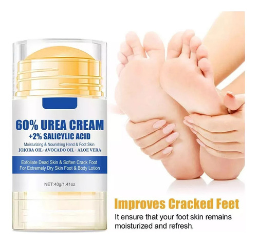 Removedor De Calos, Creme De Ureia Para Pés E Mãos