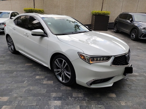 Imagen 9 de 15 de Acura Tlx2020 Servicios Agencia Tomo Auto Credito/arrendamie