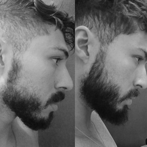 Produto Para Crescer Barba Tonico Crescimento Respeito Blend Menthol Ativo