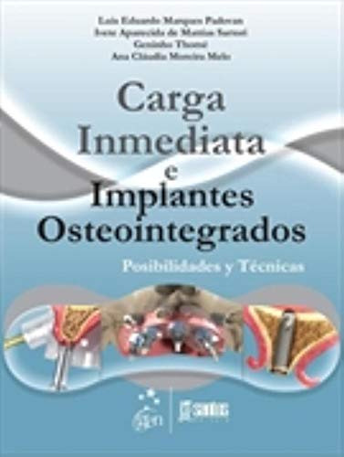 Libro Carga Inmediata E Implantes Osteointegrados De Luis Ed