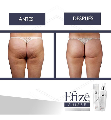 Imagen 4 de 4 de Cell'a Vie De Efizé Suisse ® - Tratamiento Anti-celulitico
