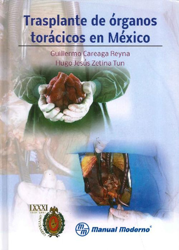 Libro Transplante De Órganos Torácicos En México De Guillerm