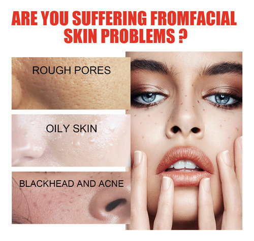 Ácido Salicílico Facial Reduz Manchas, Marcas, Encolhe Os Po