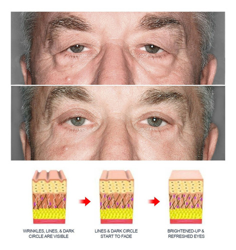 2 Peças De Creme De Olhos Masculino Reparador De Olhos