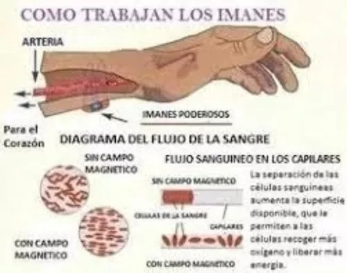 Imagen 3 de 5 de Alquiler Magneto Magnetoterapia - Zona Sur Y Todo Gba