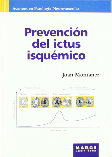 Prevención Del Ictus Isquémico - Aa.vv