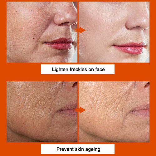 Líquido Lifting Vitamin C 30ml