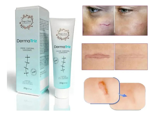 Pomada. Creme Poderoso De Cicatriz Regeneração Da Pele 20g.