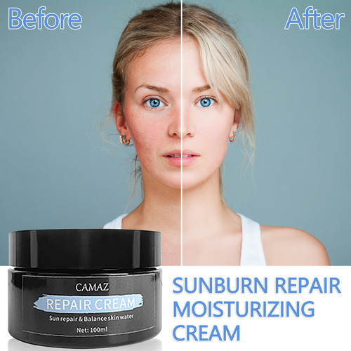 Crema Reparadora T Hidratante Reparadora De Quemaduras Solar