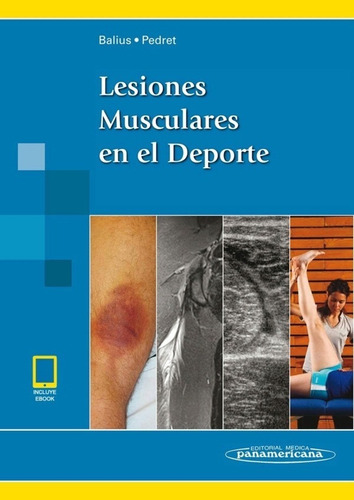 Balius Lesiones Musculares En El Deporte Y Original