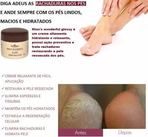Imagem 6 de 8 de Elimine As Rachaduras Nos Pés Com Hydra Power Hinode (35010)