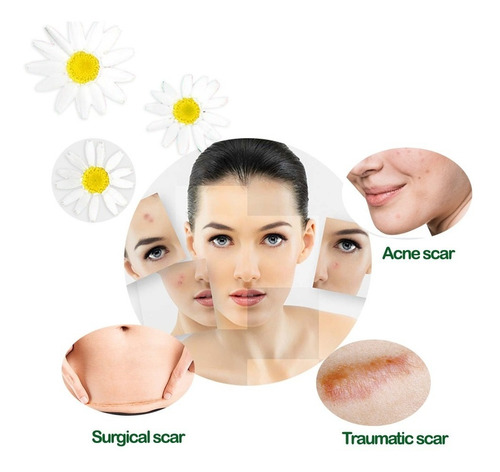 Orig Kedermfa Culebra Borra Arrugas Cicatrices Embarazo Acne