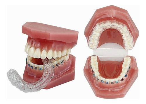 Modelo De Dientes De Ortodoncia Con Soporte Invisible