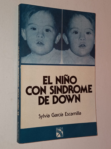 El Niño Con Síndrome De Down - Sylvia Garcia Escamilla