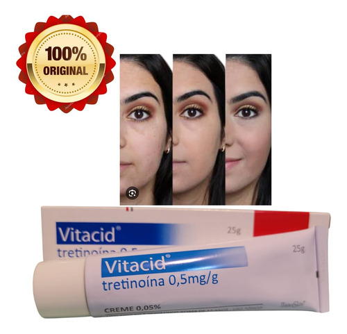 Vitacyd 0.5mg Creme Dermatológico 12+ Cuidado Da Pele Todo Tipo De Pele Noite