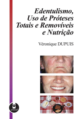 Edentulismo, Uso de Próteses Totais e Removíveis e Nutrição, de Dupuis, Véronique. Artmed Editora Ltda., capa dura em português, 2007