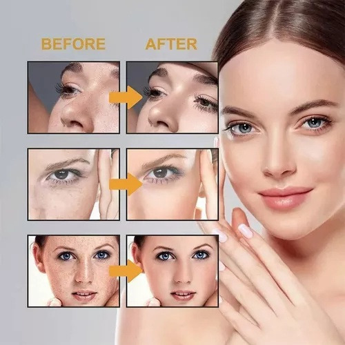 Fi Crema Japonesa For Melasma Kirozi, 2 Unidades De Crema
