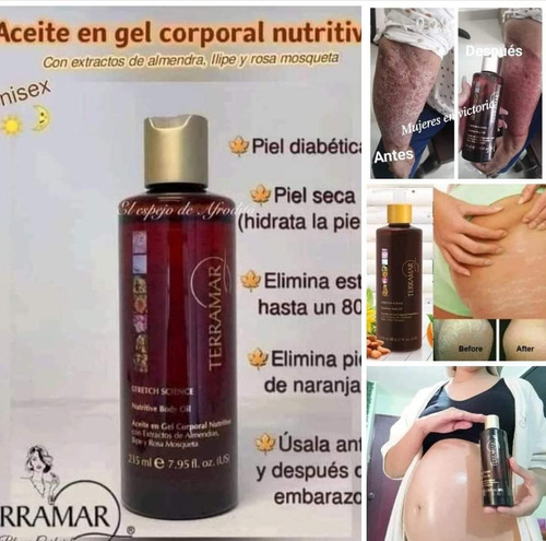 Gel De Almendras Anti-estrías Original Almendras