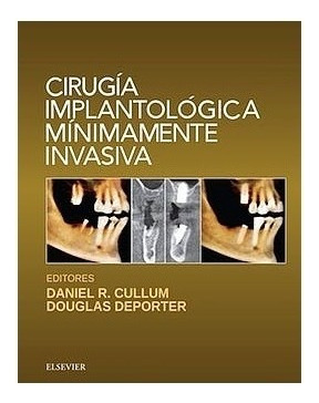Cirugía Implantológica Mínimamente Invasiva - Cullum