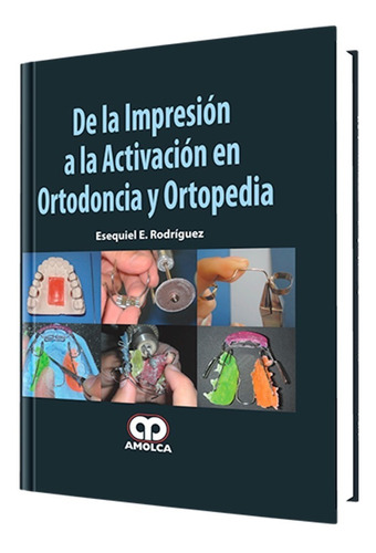 De La Impresión A La Activación En Ortodoncia Y Ortopedia.