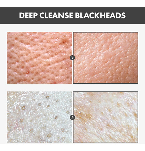 Máscara Facial De Carvão Vegetal Peel Off Pack Tosowoong Bla