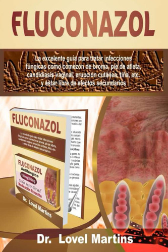 Libro: Fluconazol: La Excelente Guía Para Tratar Infecciones