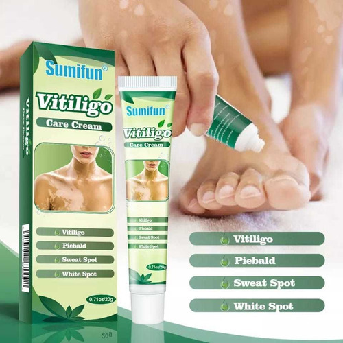 Pomada a base de hierbas para manchas en la piel Vitiligo Imed Tipo de empaque Tubo