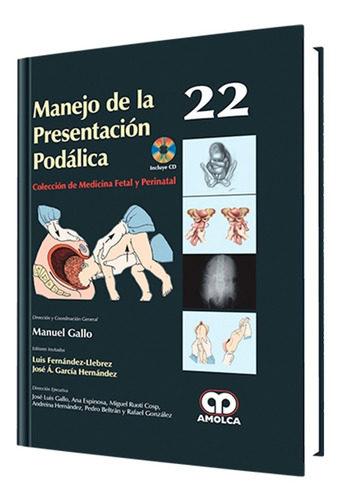 Manejo De La Presentación Podálica. Gallo Nº 22