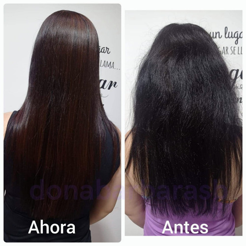 Imagen 3 de 4 de Maxilis 3 Kits