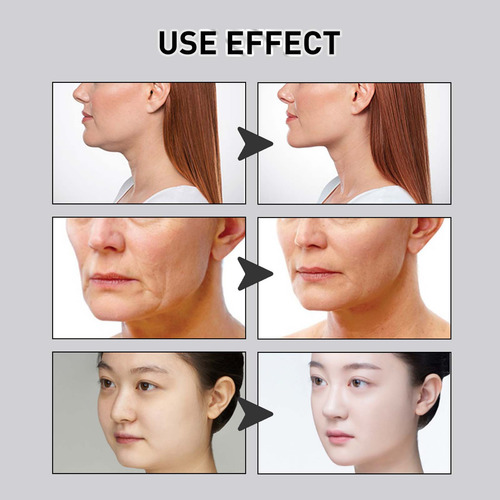 Parche De Estiramiento Facial Caído En Forma De V Para La Lí