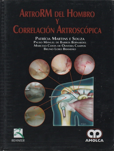 Artro Rm Del Hombro Y Correlación Artroscopica P. Martins