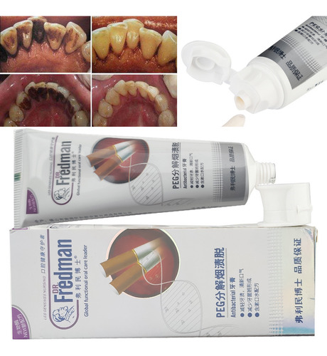 110g De Higiene De Carvão Vegetal Creme Dental Branco Para H