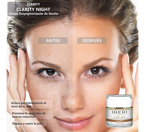 Imagen 3 de 9 de Crema Facial Aclarante Despigmentante Antimanchas De Noche Para Todo Tipo De Piel Con Manchas O Decolorada Línea Clarity Ireri ®
