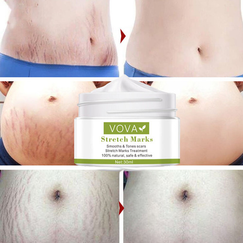 Crema Para Estrías Z 30 Ml Y Parabeno | Crema Para Estrías