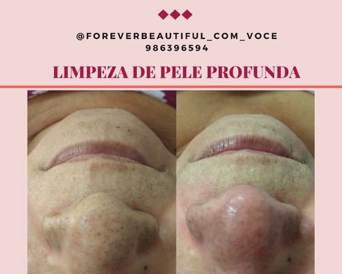 Imagem 5 de 5 de Forever Beautiful Estética