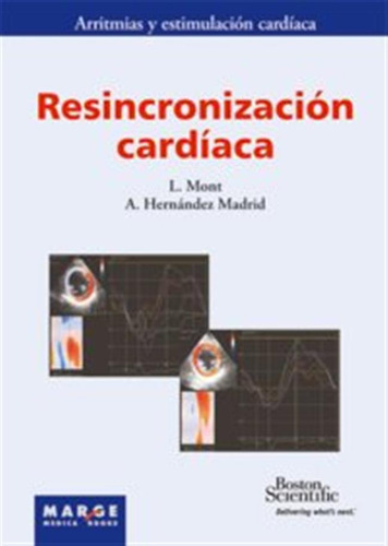 Resincronizacion Cardiaca - Mont I Girbau,josep Lluis