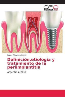Libro Definicion, Etiologia Y Tratamiento De La Periimpla...