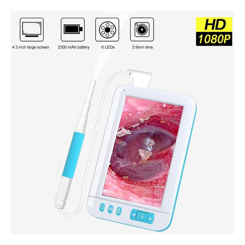3.9mm Hogar Visual Inteligente Ear Pick De Mano Otoscop